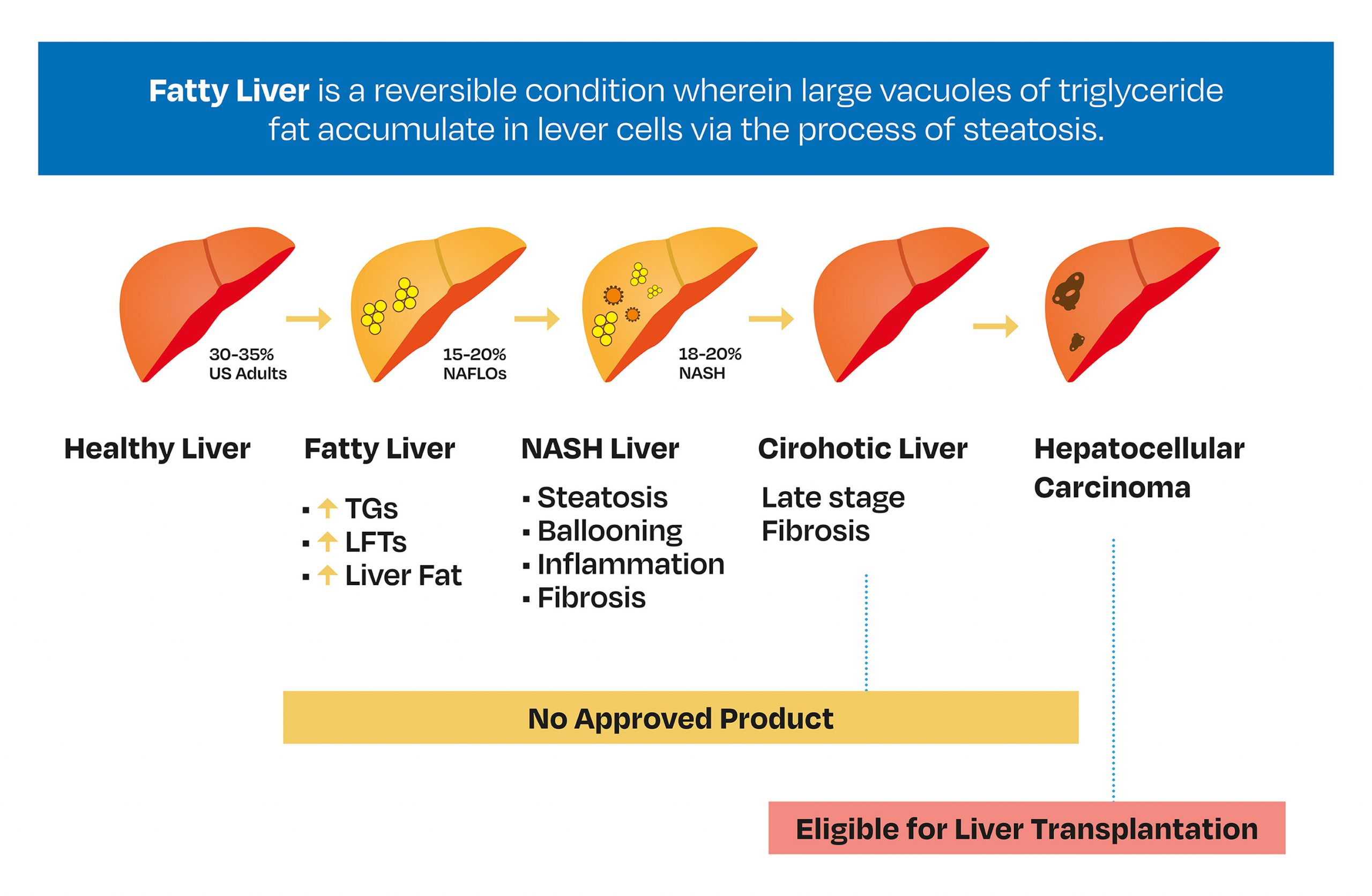 exploristics-Liver-Biomarker-Treatment-options